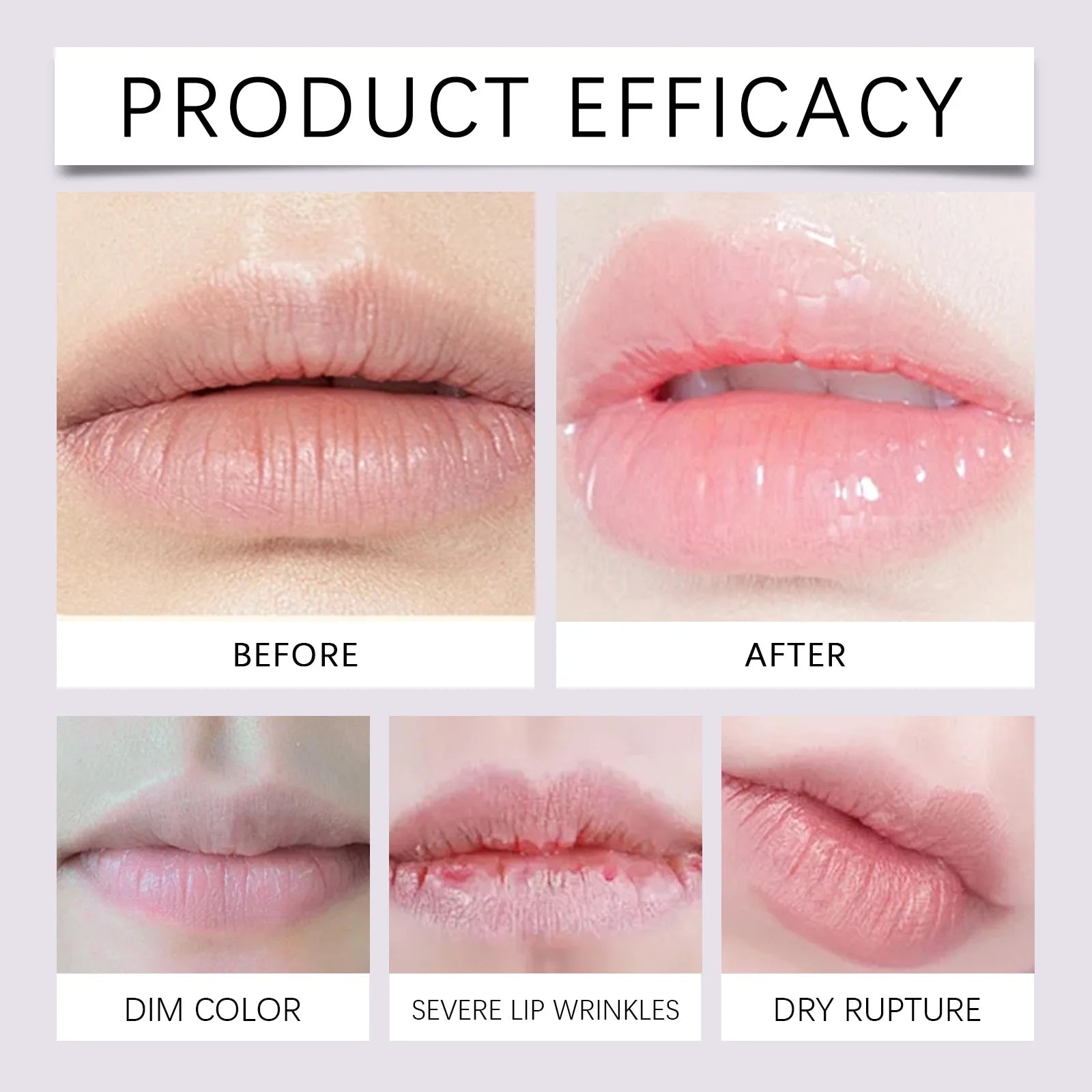 Lip Care Set  Nourishing & Moisturizing Lip Balm Treatment for Dry Lips,  Gentle Repair for Soft Smooth Lips, Lip Care Kit