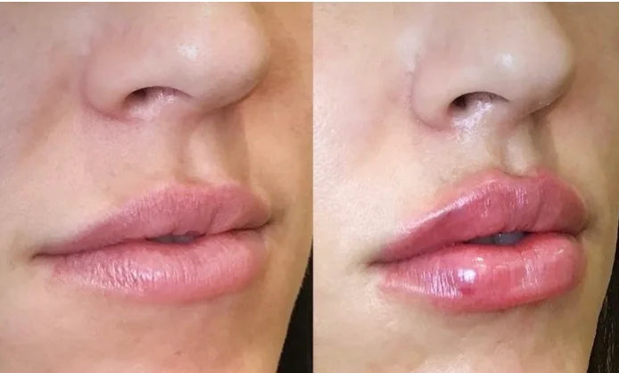 Lip Care Set  Nourishing & Moisturizing Lip Balm Treatment for Dry Lips,  Gentle Repair for Soft Smooth Lips, Lip Care Kit
