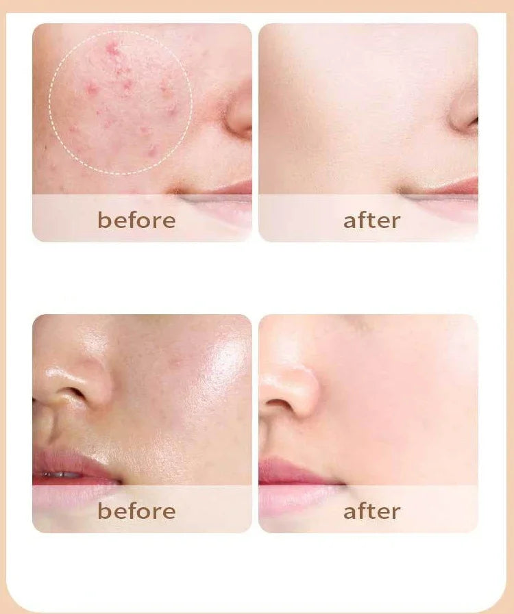 4 Colors Liquid Concealer Cream Waterproof Moisturizing Long Lasting Cover Acne Dark Circles Foundation Contouring Cosmetics